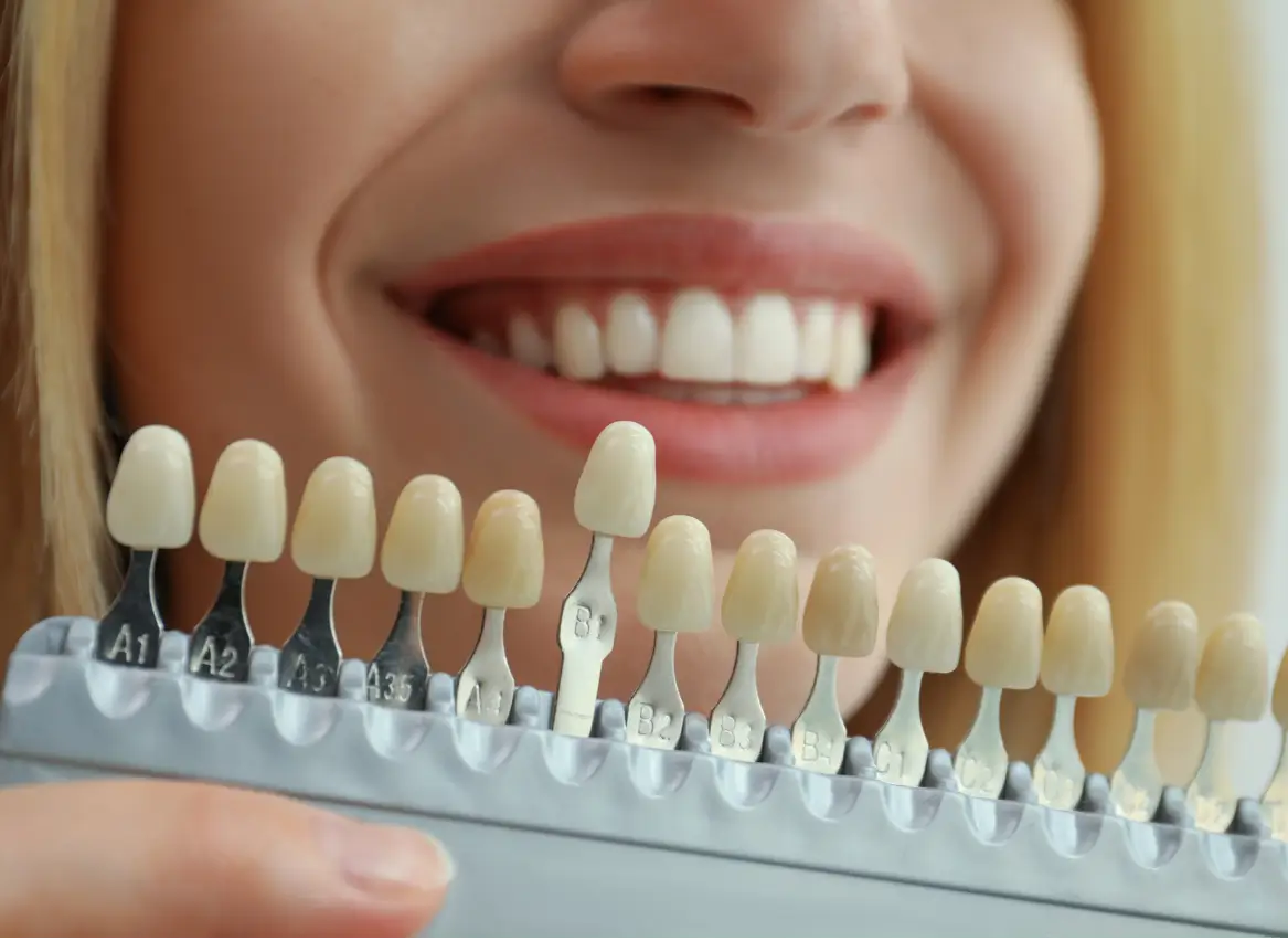 Cosmetic Dentistry at Metro Scott Dental