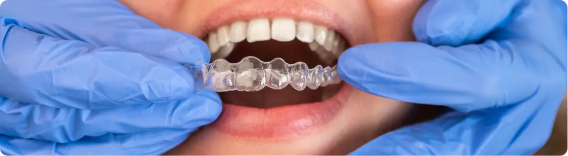 Patient receiving Invisalign treatment at Metro Scott Dental
